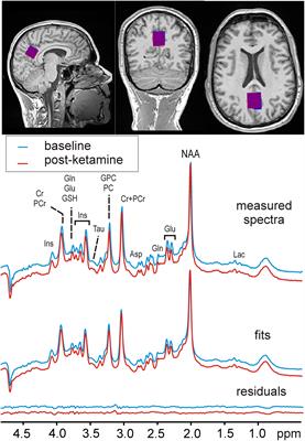 Effect of Ketamine on Human Neurochemistry in Posterior Cingulate Cortex: A Pilot Magnetic Resonance Spectroscopy Study at 3 Tesla